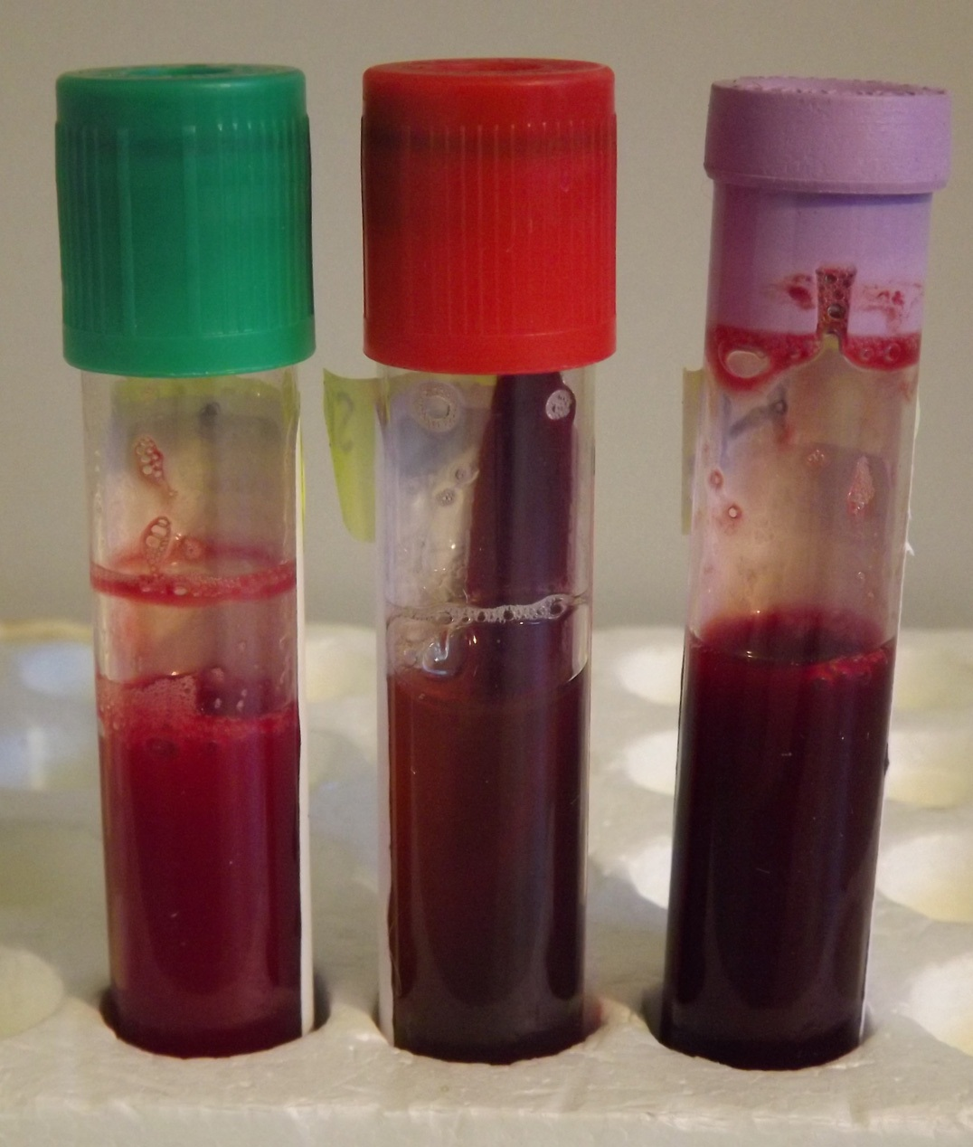 Selecting The Right Blood Test Tube And Techniques For An Accurate Diagnosis Agriculture And Food