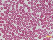 Blood smear from a healthy sheep showing red blood cells closely packed together. (The cells do not contain the blue-stained organisms, M. ovis.) Photo: Mark Bennett, Murdoch University
