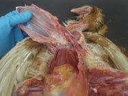 Removing the sternum