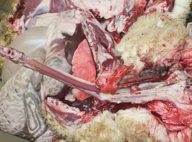 Dissecting the neck