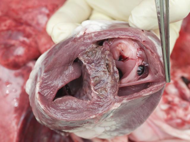 Dissecting the heart