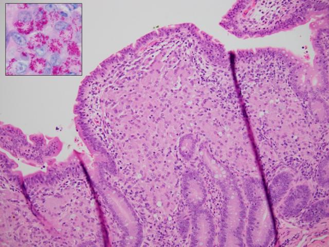 Figure 1: Histopathology of OJD