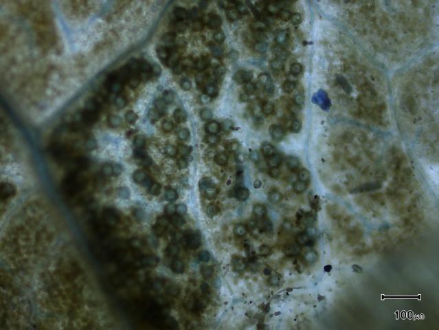Oospores in a leaf