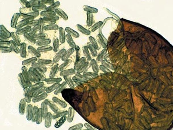 Microscopic photograph of nematode cysts showing several hundred eggs (Ulrich Zunke, University of Hamburg, Mactode Publications)