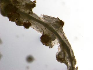 Root knot nematode as seen under a microscope.