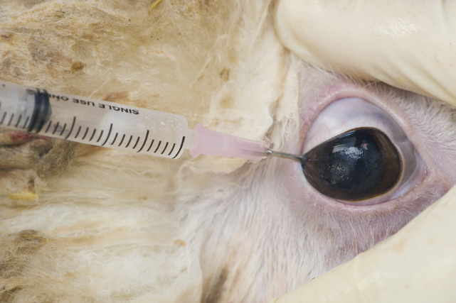 Collecting vitreous humour from the posterior chamber of the eye.