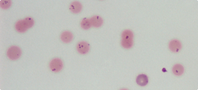A blood smear from a sheep with eperythrozoonosis. The large gaps between red cells indicate anaemia. The blue-stained organisms within the cells are M. ovis. Photo credit: Mark Bennett, Murdoch U