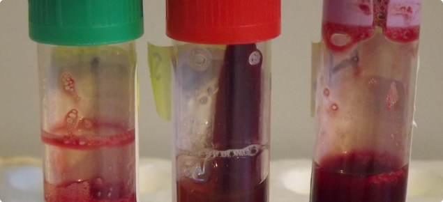 Common blood tubes: lithium heparin (green), clotted (red) and EDTA (purple)