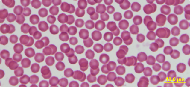 Blood smear from a healthy sheep showing red blood cells closely packed together. (The cells do not contain the blue-stained organisms, M. ovis.) Photo: Mark Bennett, Murdoch University