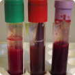 Common blood tubes: lithium heparin (green), clotted (red) and EDTA (purple)